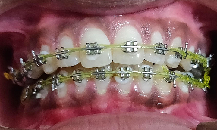 Orthodontics